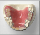 画像：プラスチック義歯(上から)