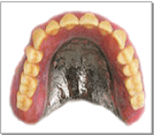 画像：チタン床義歯